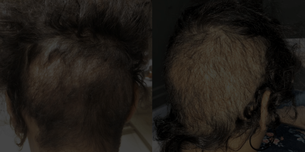 subhero home page copy 2